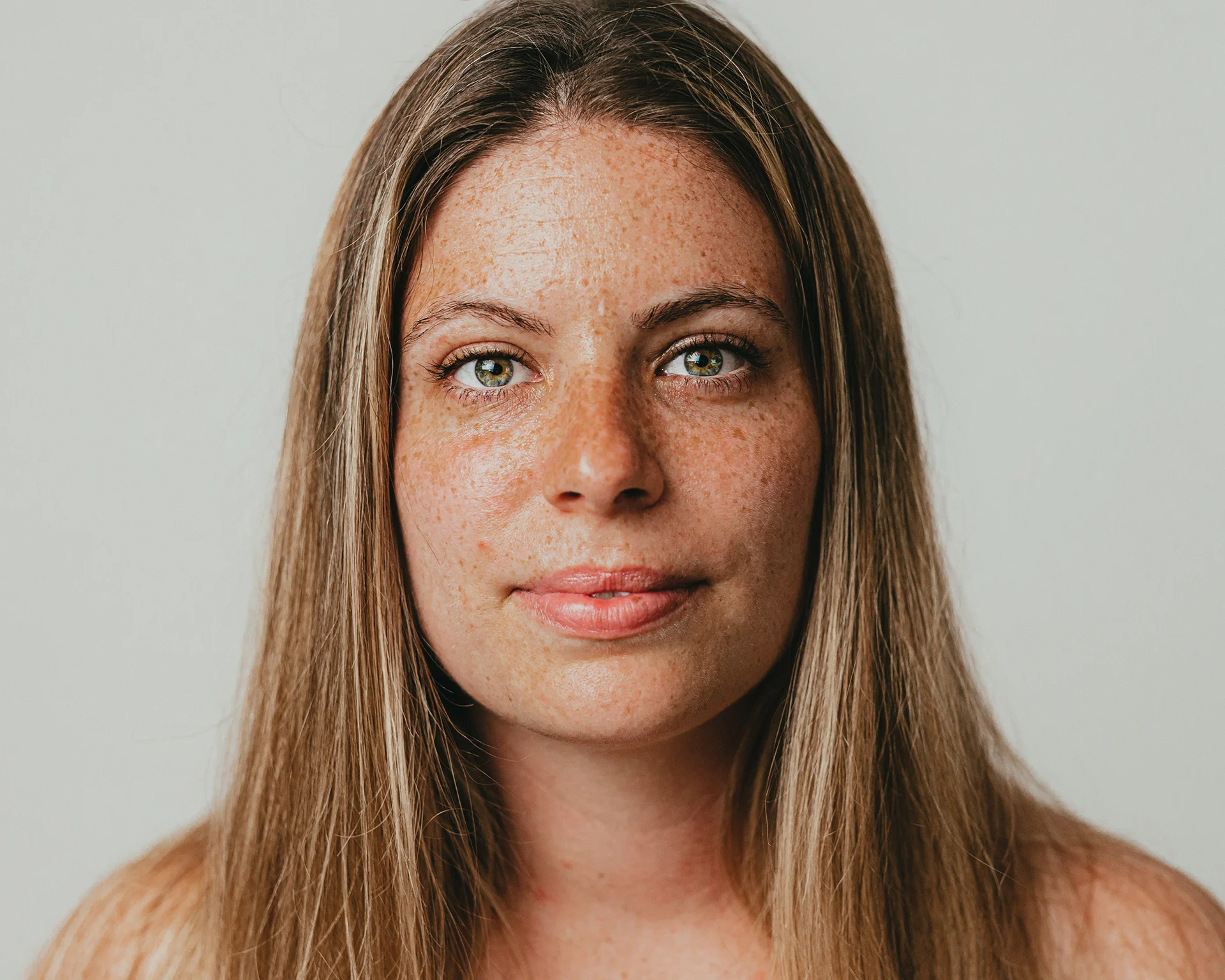 Young woman looking straight at the viewer with clear, bright eyes. She has beautiful skin covered in freckles.